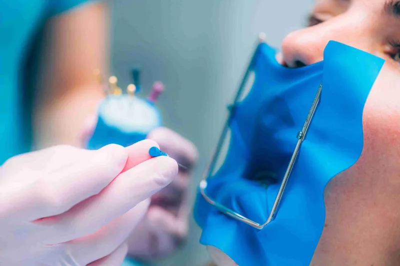 Endodoncia